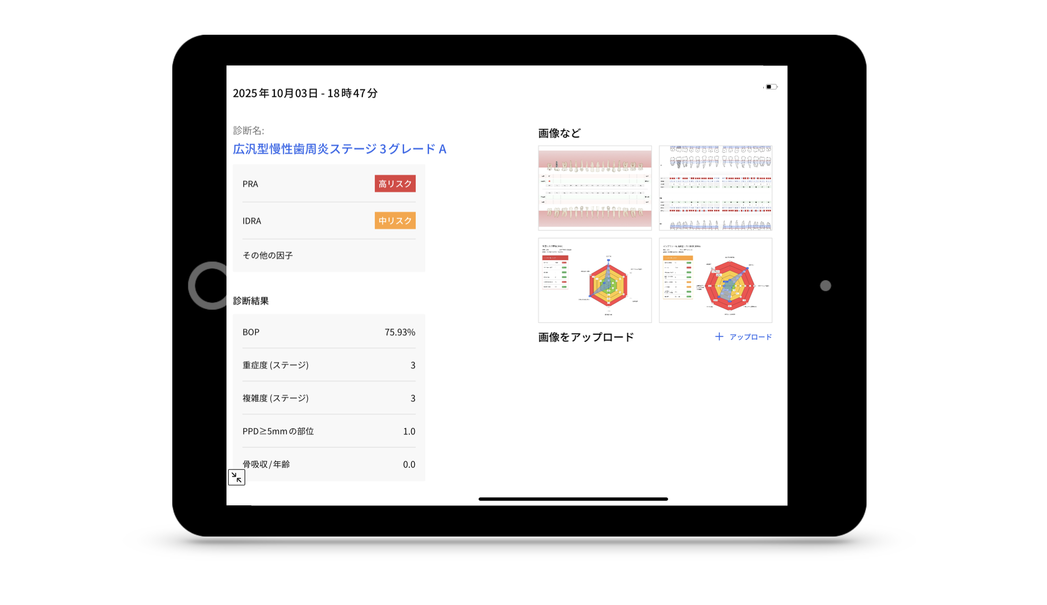 歯周・インプラント治療における再生療法 歯周・インプラント治療における再生療法 | 船登 彰芳, 片山